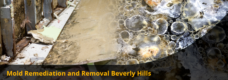 Mold Remediation and Removal Beverly Hills CA